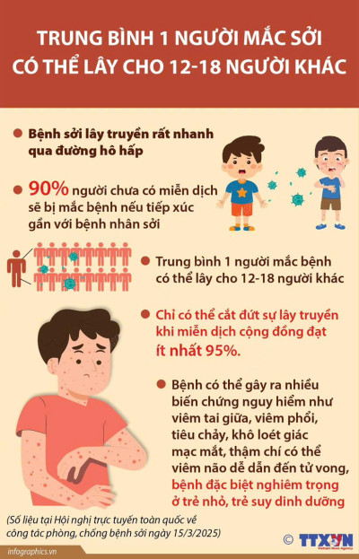 Bệnh sởi