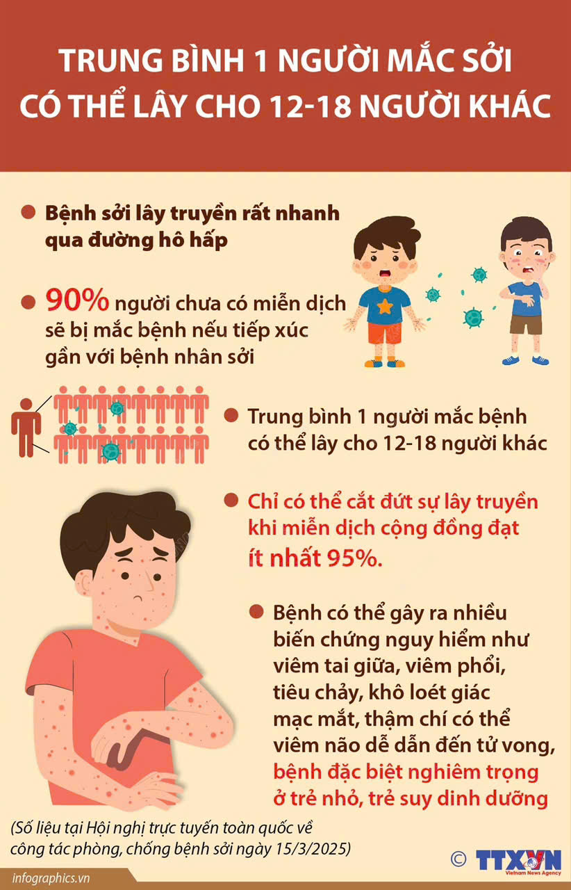 Bệnh sởi